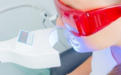 101 Of Teeth Whitening Treatment – Everything You’ll Need To Know