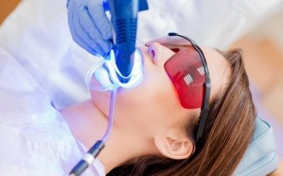 The Ultimate Guide to Teeth Whitening in Singapore