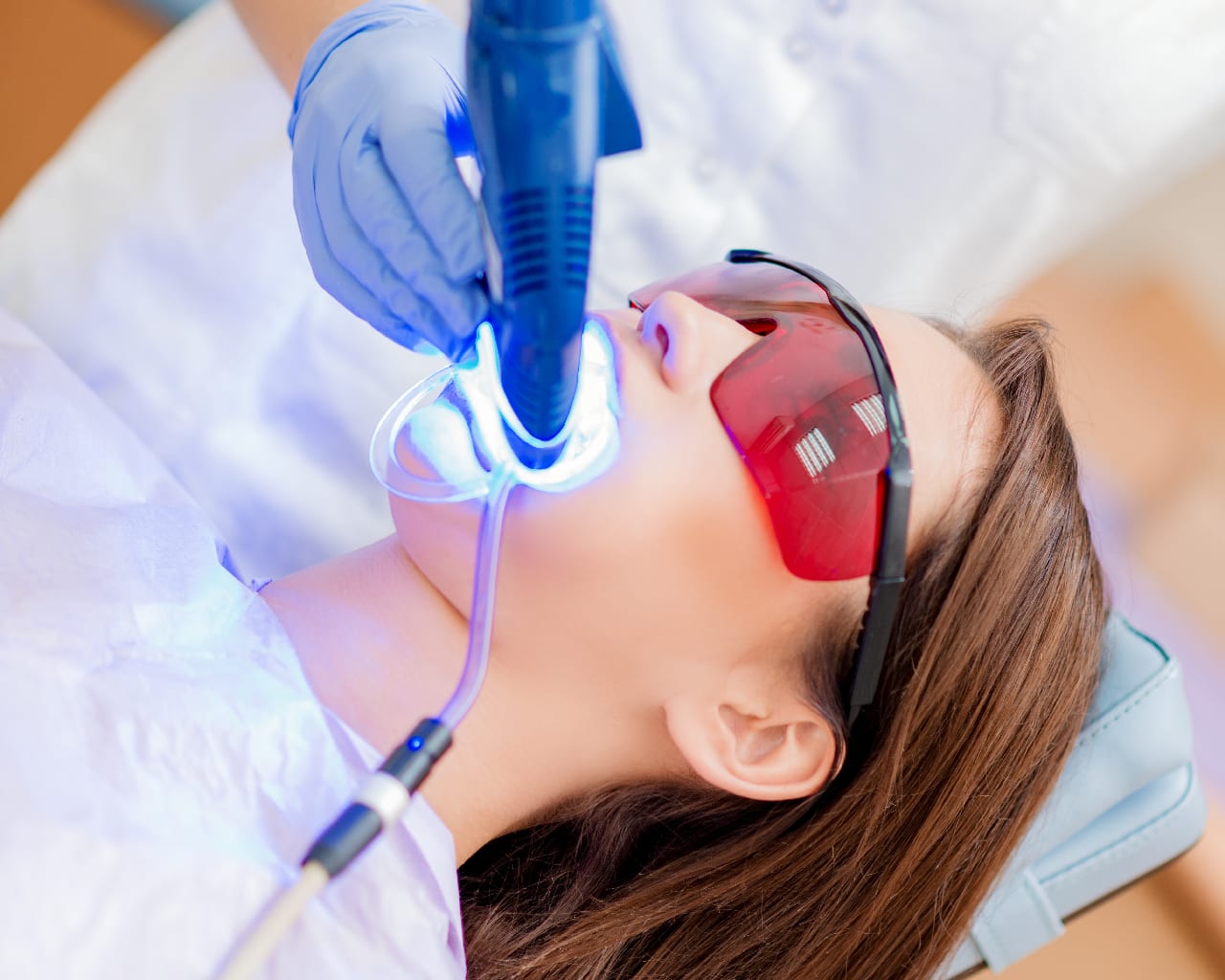 teeth whitening in singapore