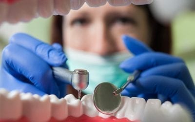 Dental Implants – Are They Really Worth It?
