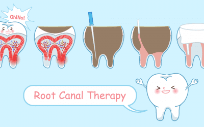 Root Canal Treatment – The Magic Within The Tooth