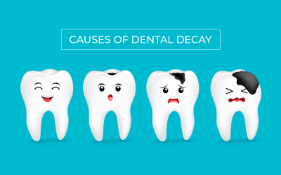 Causes of Dental Decay