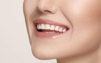 Total Smile Makeover in Singapore