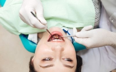 Commonly Asked Questions About Dental Fillings