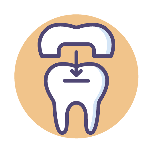 Dental Crown
