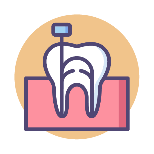 root canal treatment in singapore | endodontic treatment