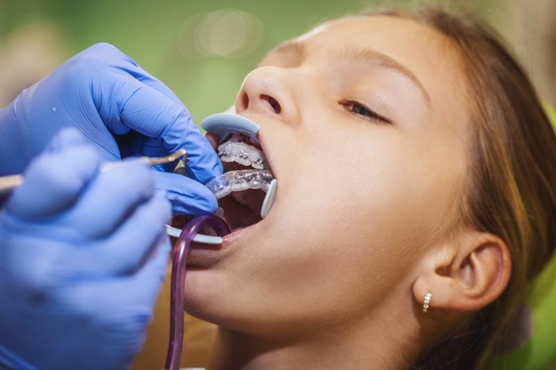 asian lady smiling with a clear aligner in her hand