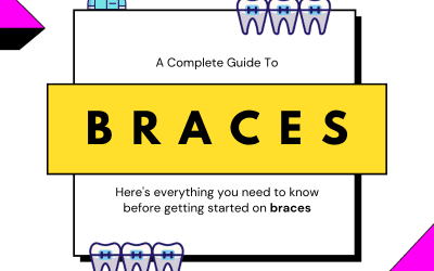 The Comprehensive Guide to Braces (2020)