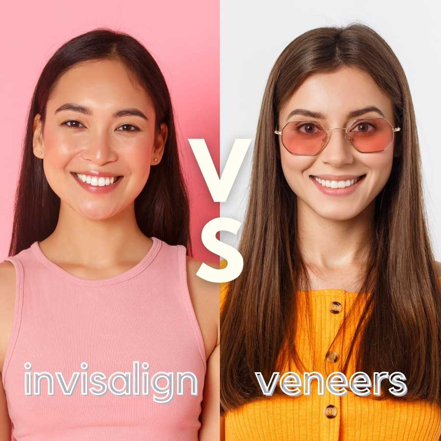 Invisalign vs Veneers in Singapore | Which is better?