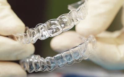 3 Types of Retainers in Singapore [+Cost & FAQs]