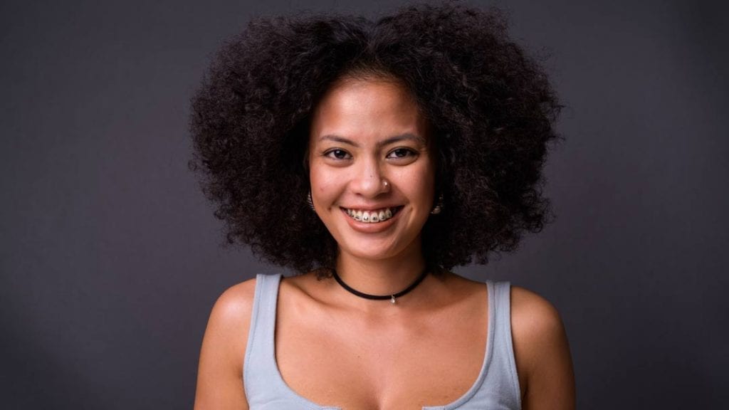 teenage wearing self ligating braces