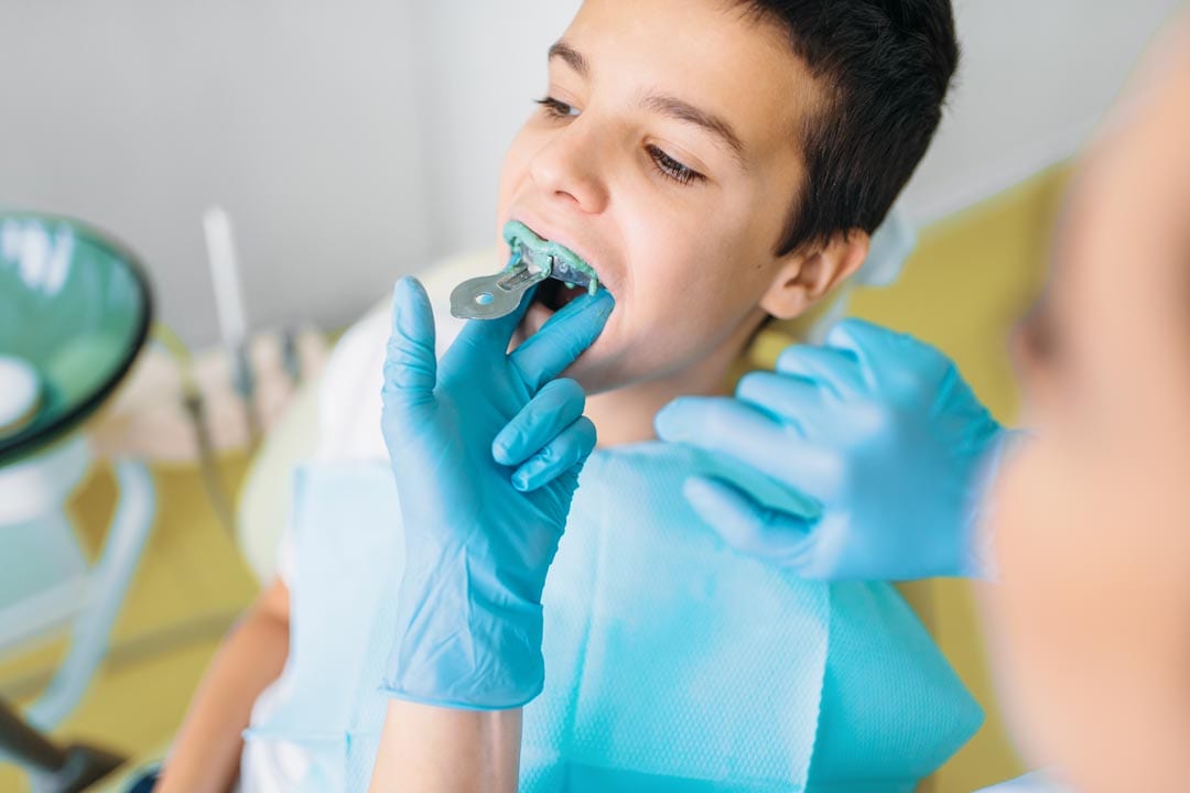 dental records for Invisalign First