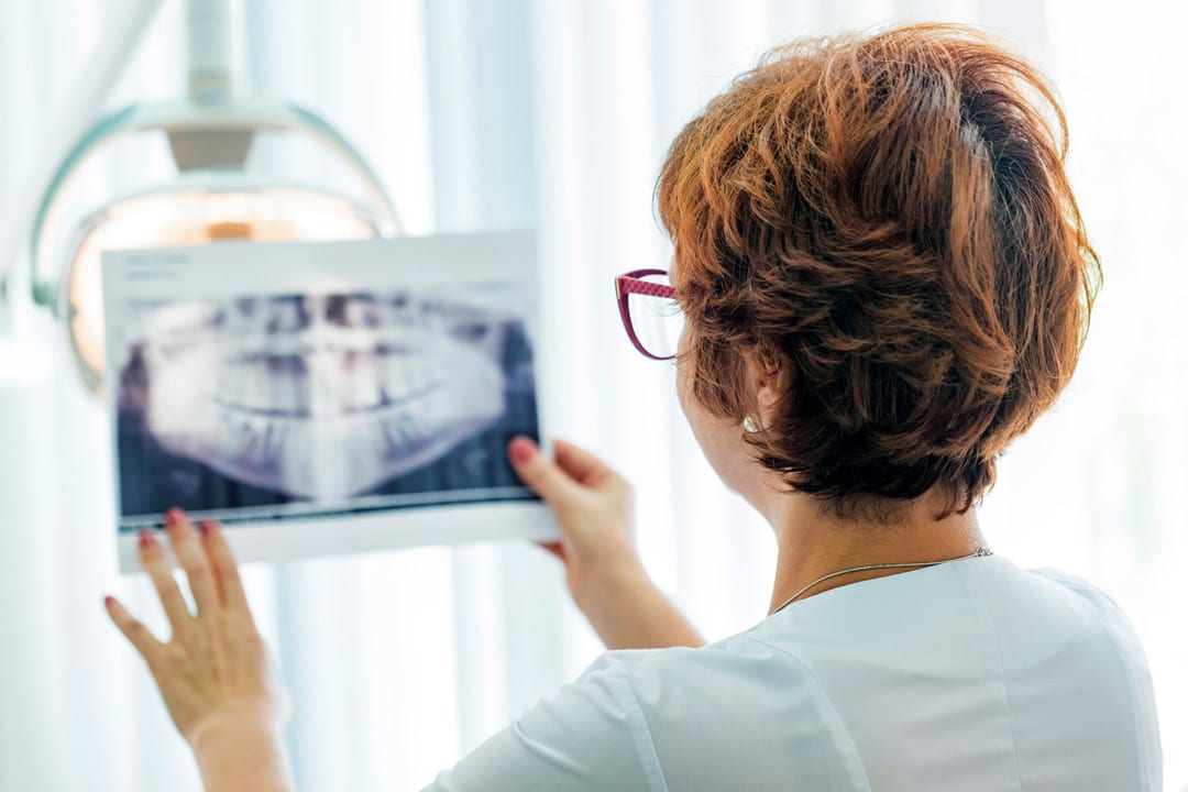 dentist-examining-xray-of-a-patient---finding-Pericoronitis dentist examining a patient's dental xray - checking for Pericoronitis