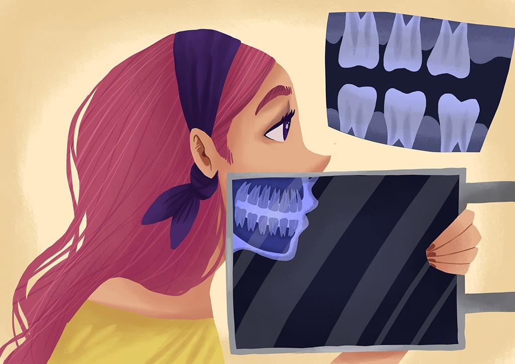 insufficient-bone-in-upper-jaw insufficient bone in upper jaw
