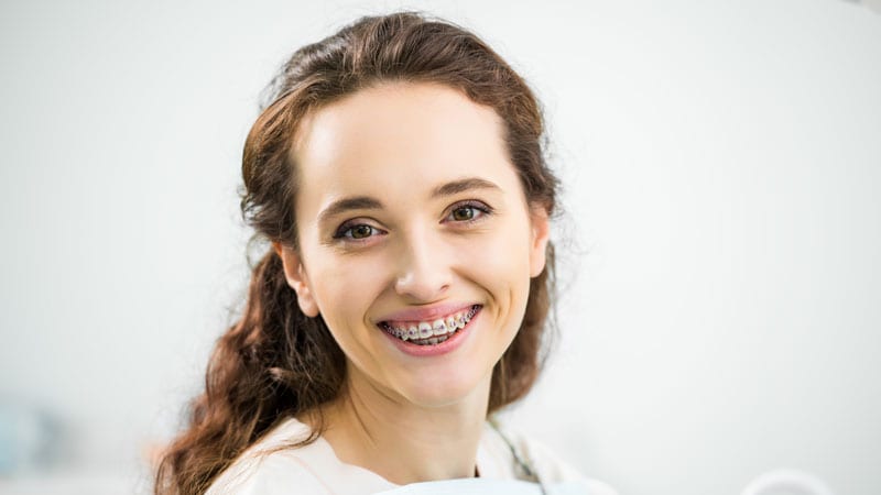 matching braces to eye colour