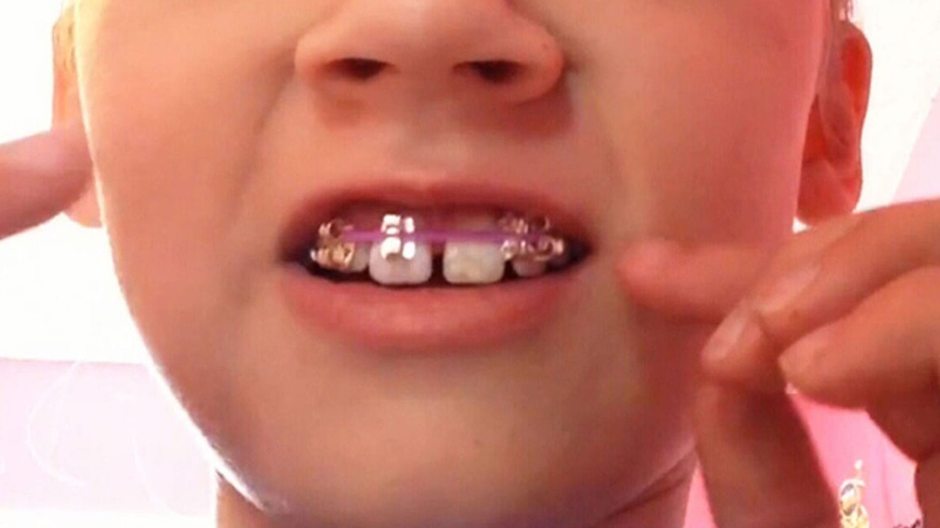 Child playing with DIY braces