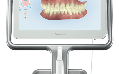 Intraoral Scanning & Digital Dentistry: iTero Elements 2