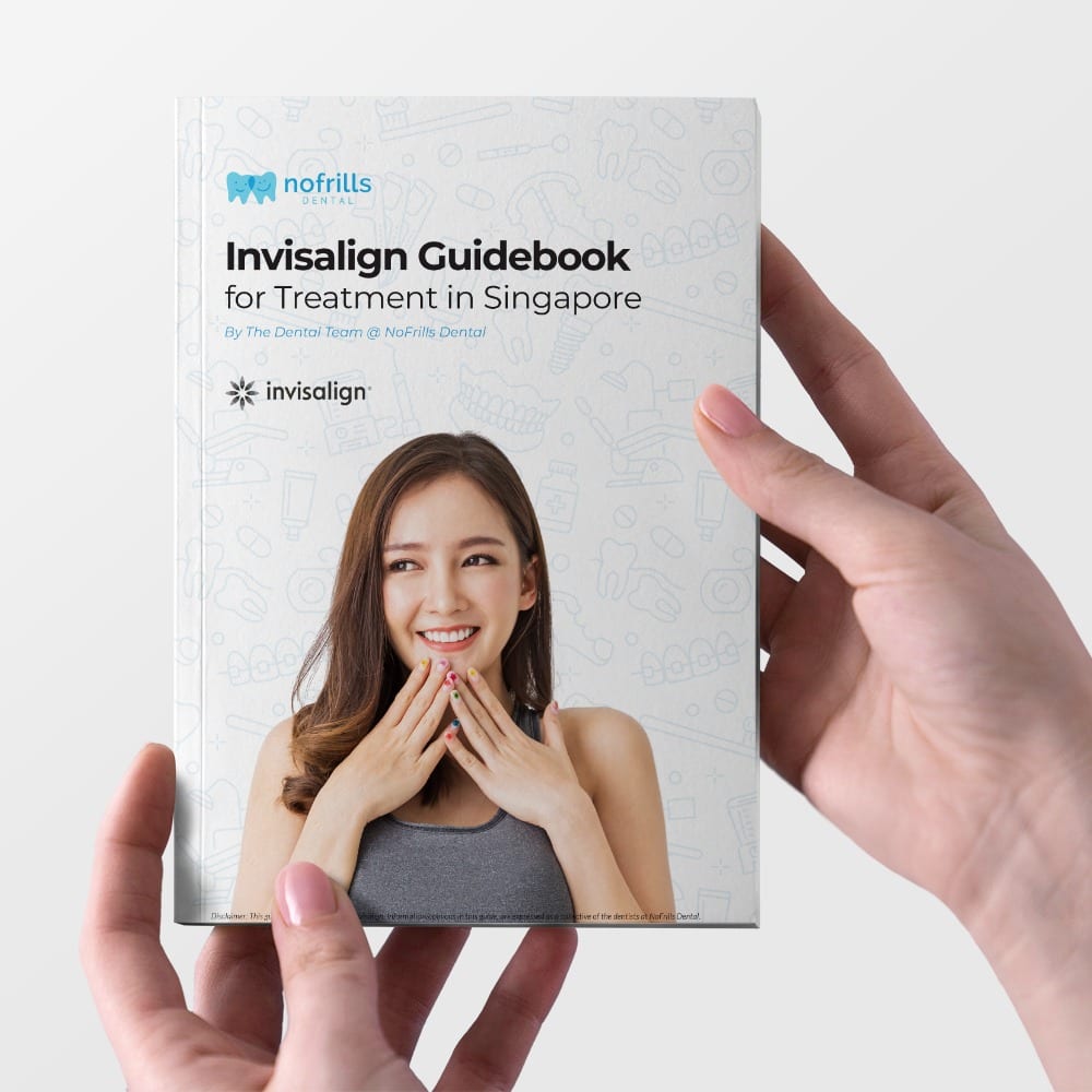 Invisalign Guidebook 2021