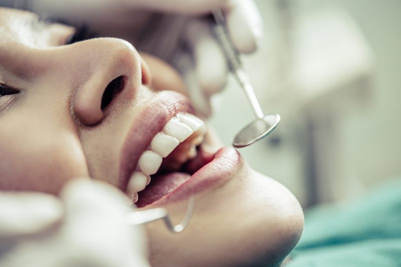 dental crown checkup