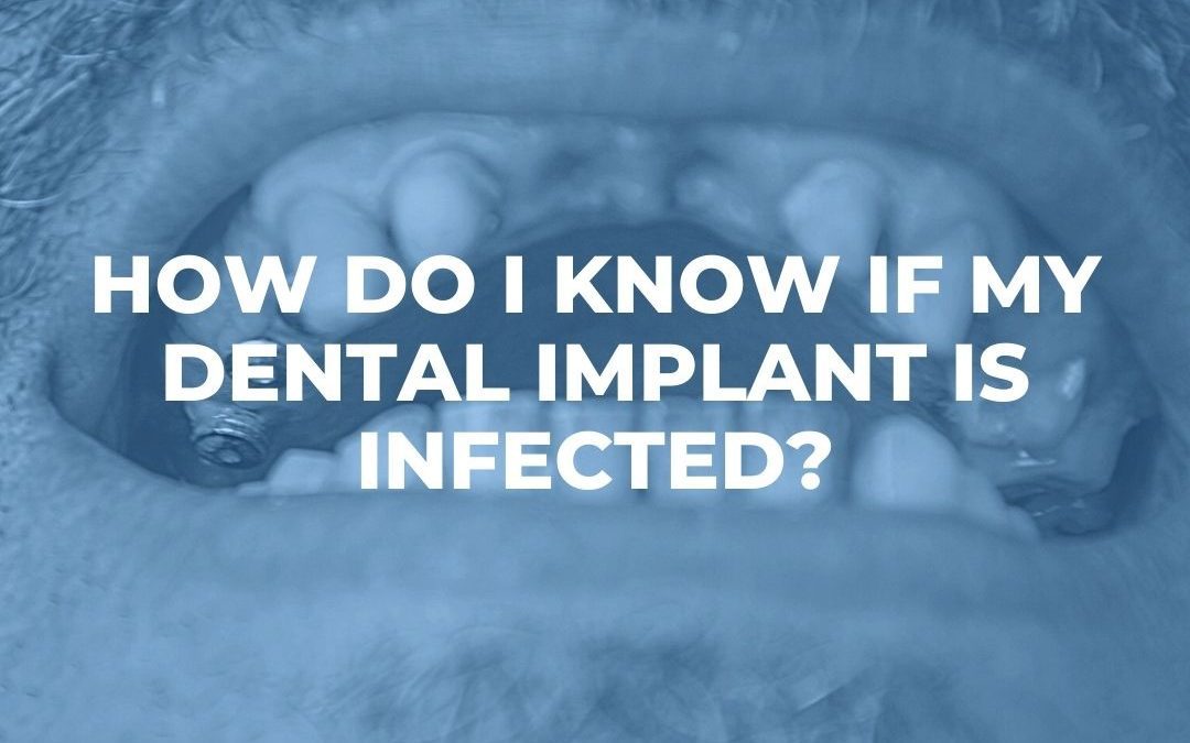 how do I know if my dental implant is infected?