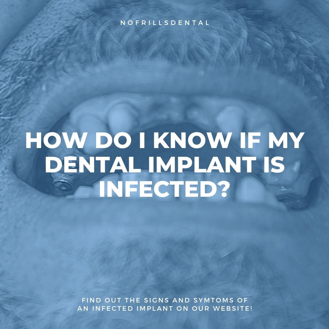 How do I know if my Dental Implant is infected? NoFrills Dental