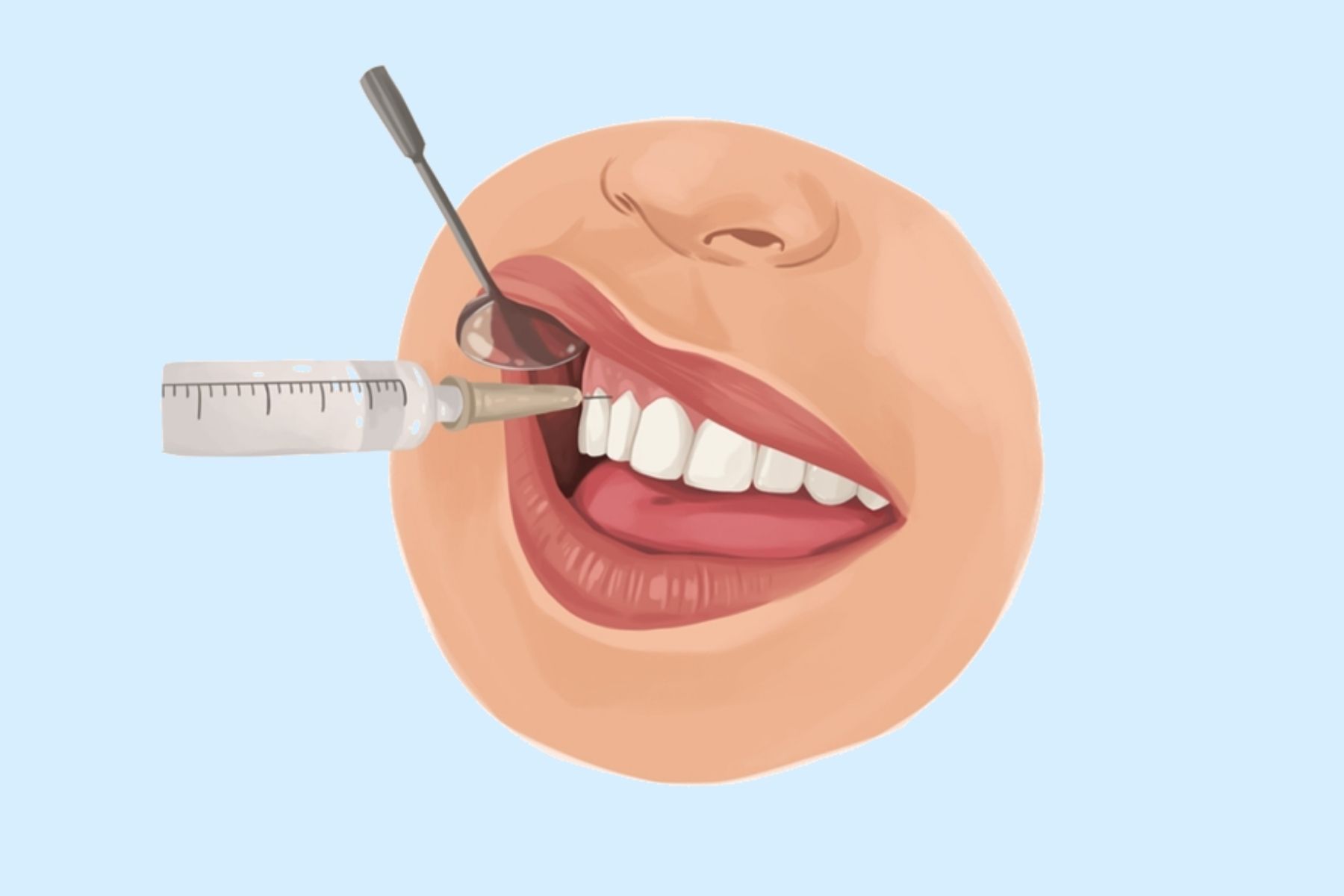 Local Anesthesia Local Anesthesia