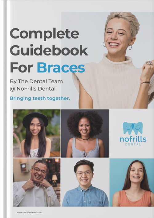 braces guidebook cover page