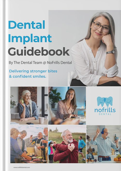 dental implant guidebook cover