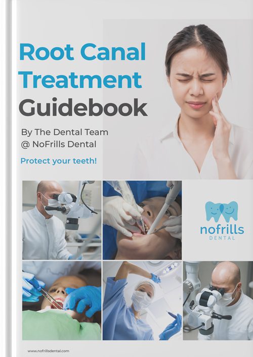 Root canal guidebook cover