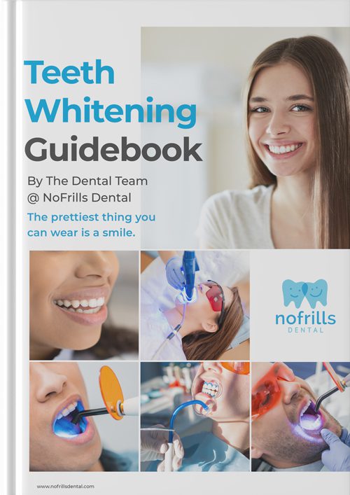 teeth whitening guidebook