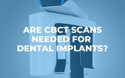 Are CBCT Scans Needed for Dental Implants?