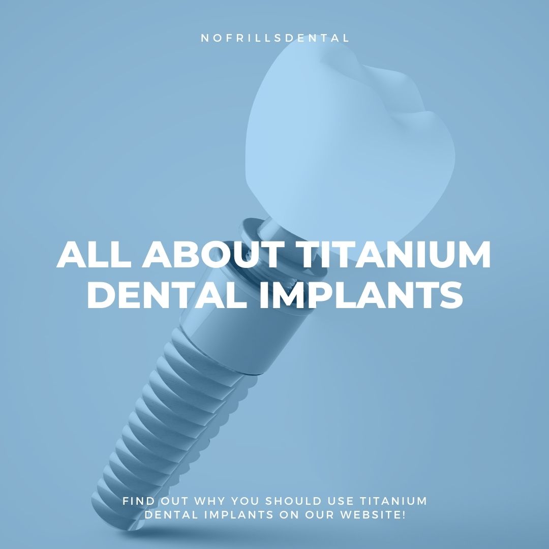 All about titanium dental implants NoFrills Dental