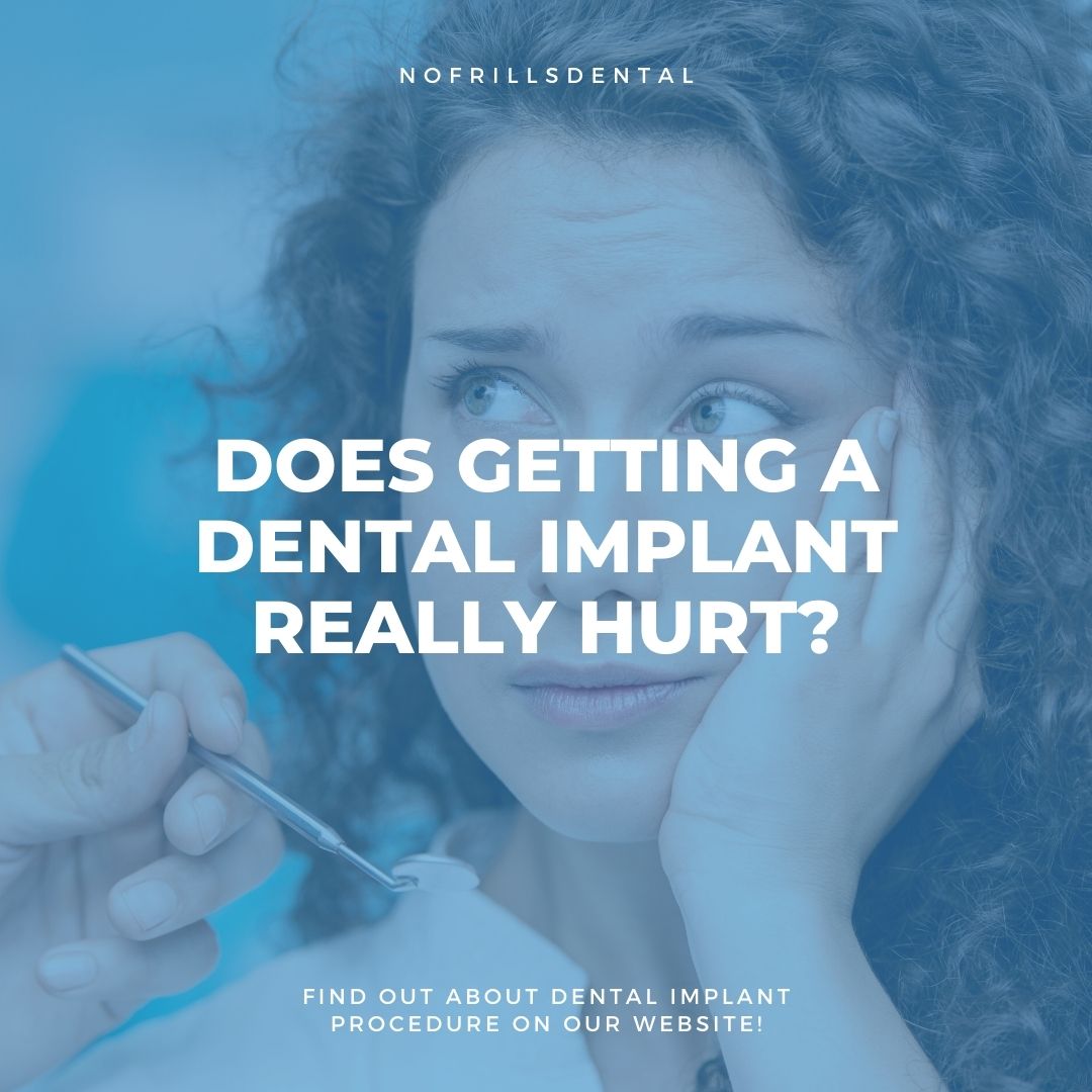How Painful is Getting a Dental Implant?
