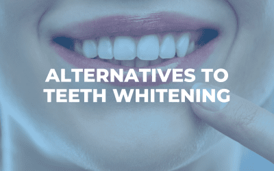 Alternatives to Teeth Whitening