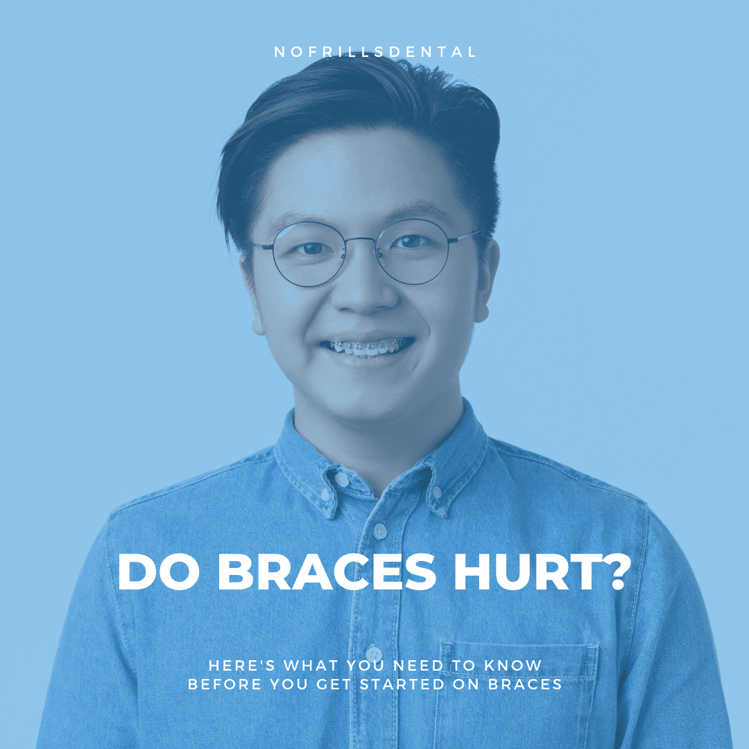 Do braces hurt?