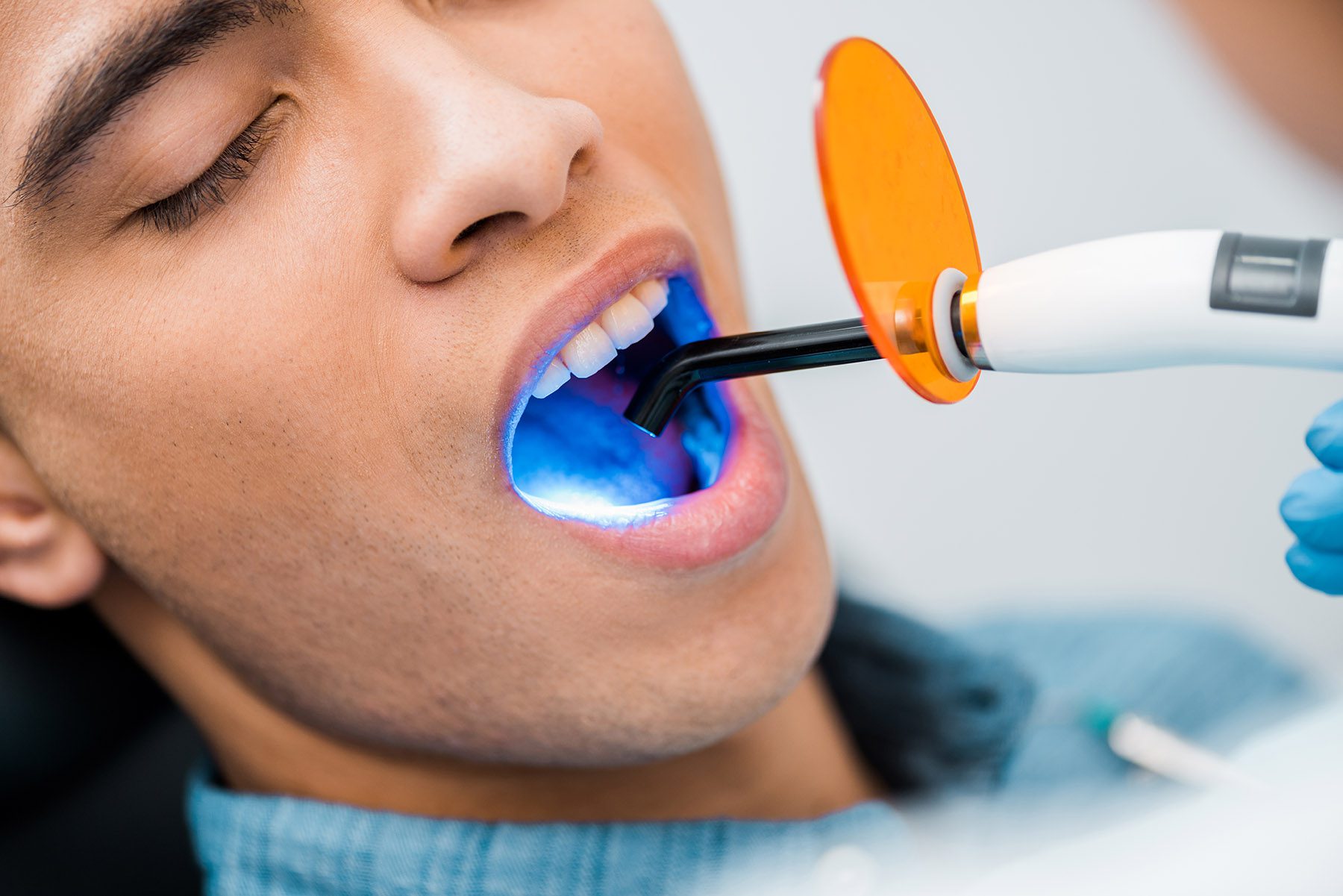 man getting teeth whitening treatment man getting teeth whitening treatment