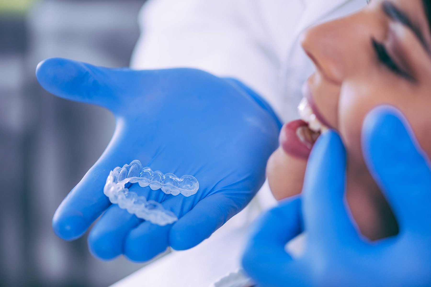 prescription teeth whitening tray prescription teeth whitening tray