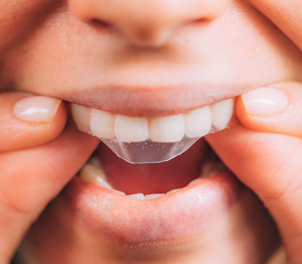 teeth whitening strip teeth whitening strip