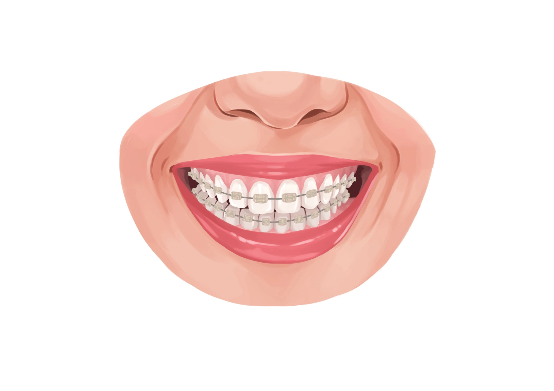 28ce9e98c77f37f8c742e925d7c541d7 woman suffering from implant allergy