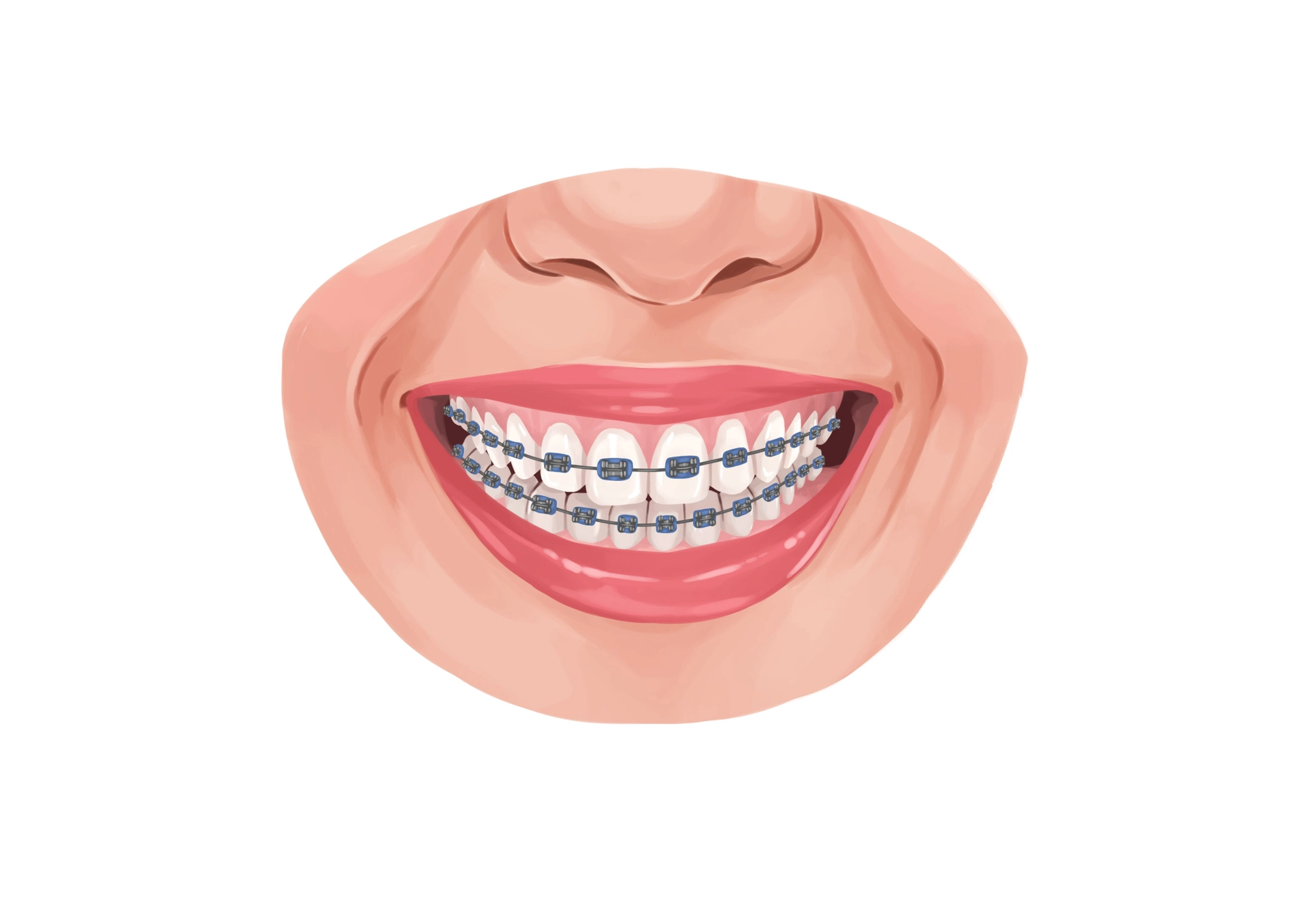 9d555e4cae7aba3901de1bd4e70692fa woman suffering from implant allergy