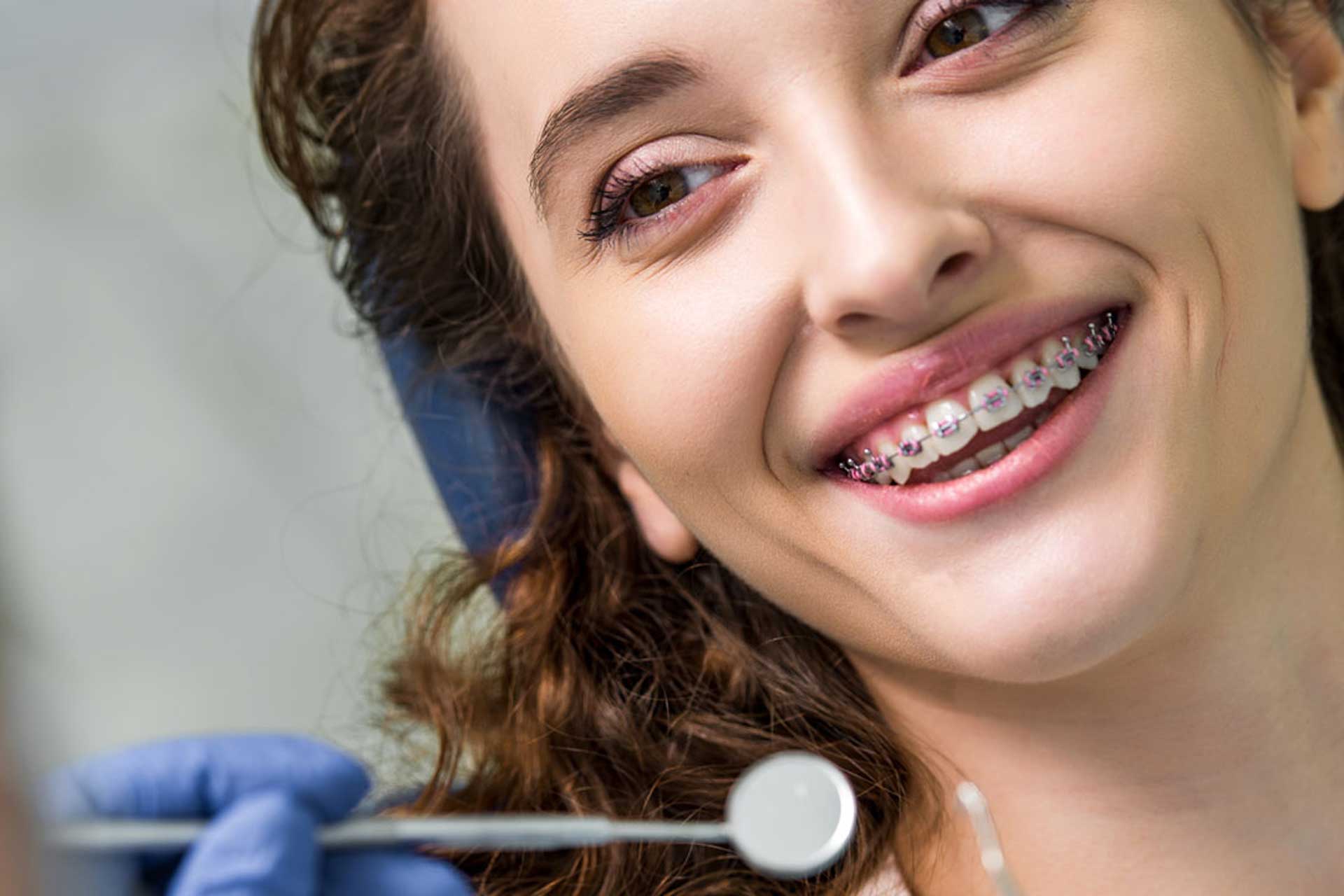 braces removal and placement