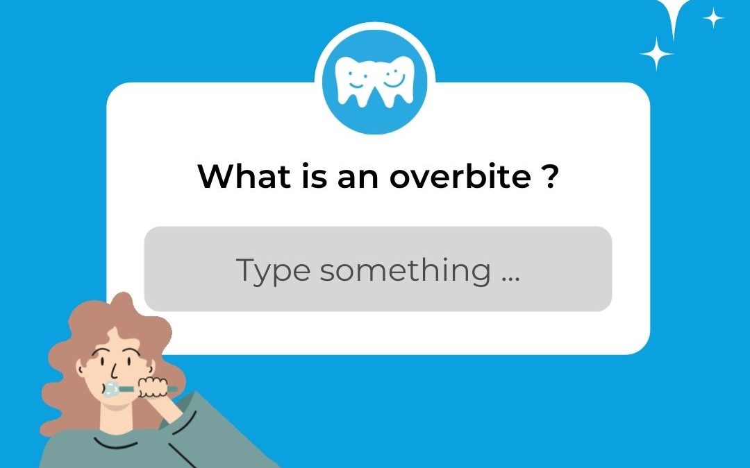 overbite featured image