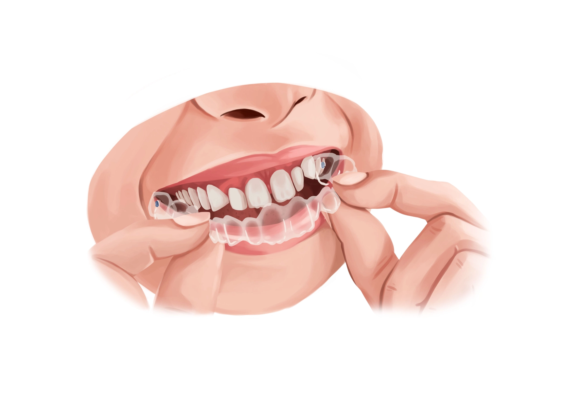e3da1f98d7d298405b4623063ec7fe0f woman suffering from implant allergy
