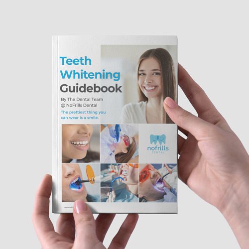 Teeth Whitening Guidebook Cover