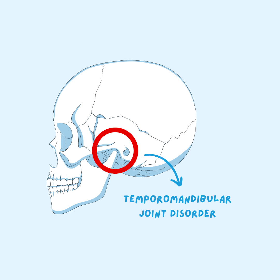 jointdisorder_rec jointdisorder_rec