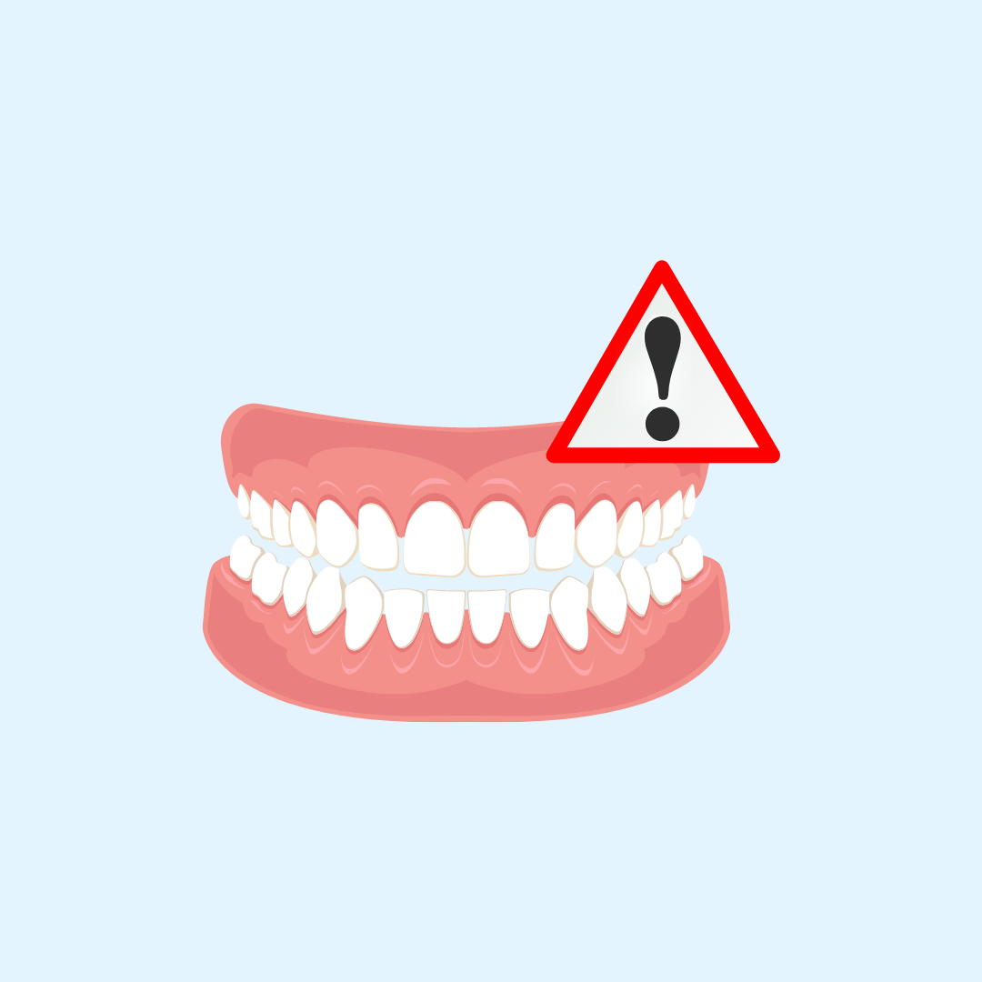 Risks_Rec Risks_Rec