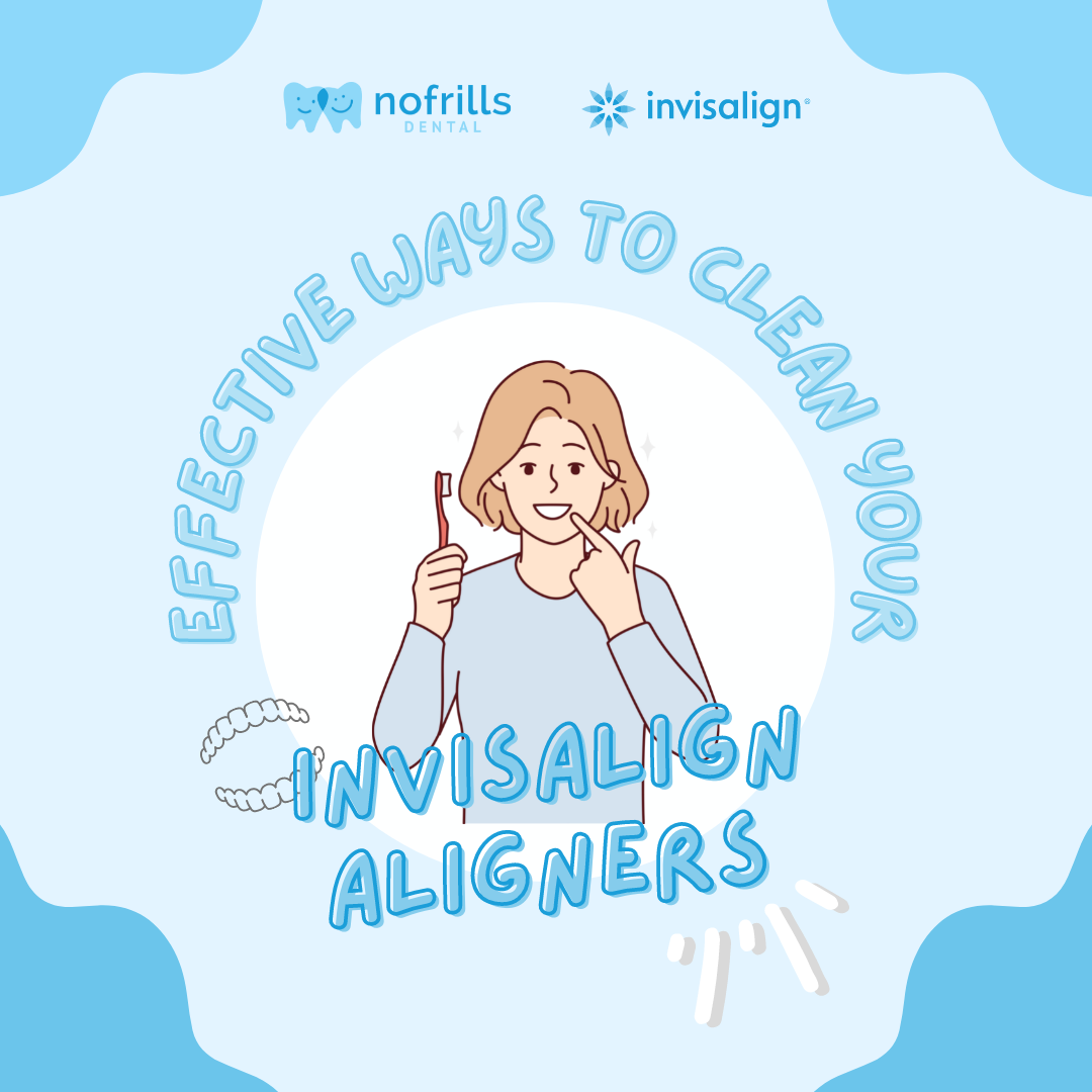 The Do's and Don'ts of How to Clean Invisalign Trays