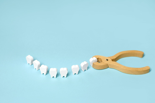 tooth extraction graphic
