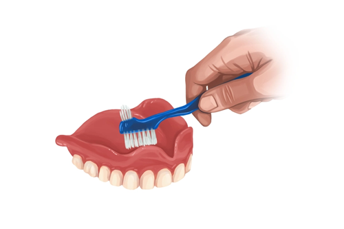 cleaning removable dentures
